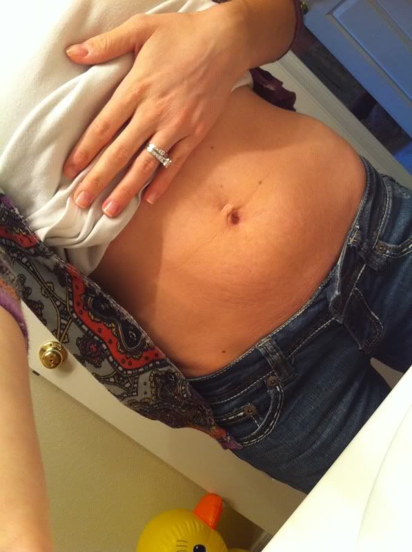 My belly button piercing made for one nasty stretch mark along with the 