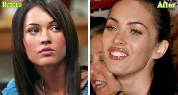 megan fox plastic surgery before and after photos. hair Megan Fox Cosmetic